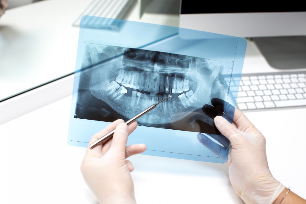 Digital X-Ray1-100kb