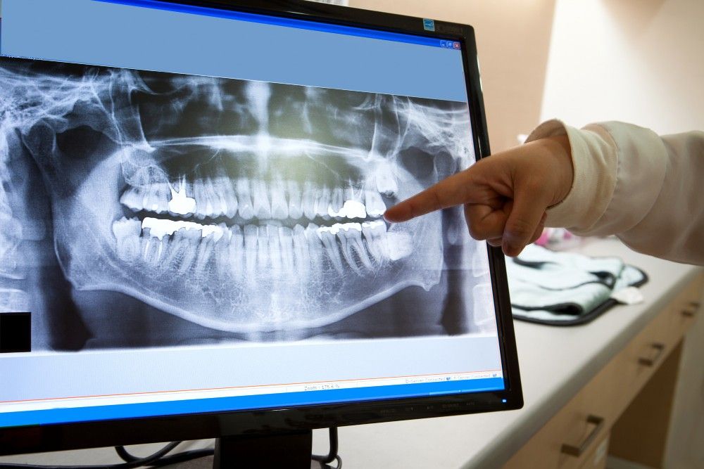 Digital X-Ray3-100kb