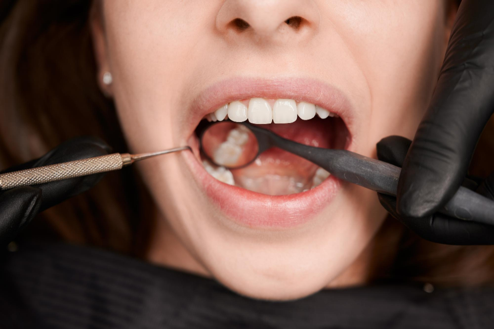 Gum Surgeries3