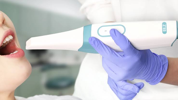 Intraoral Scanning1