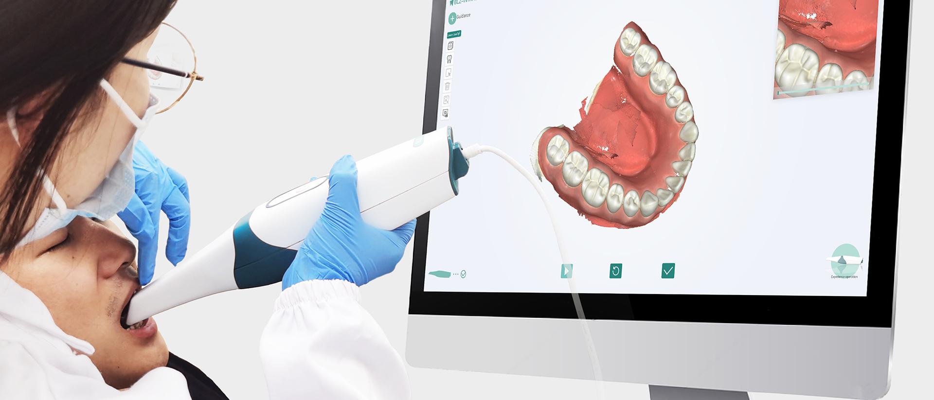 Intraoral Scanning3