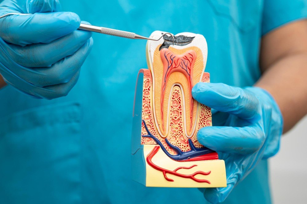 Root Canal Treatment2-100kb