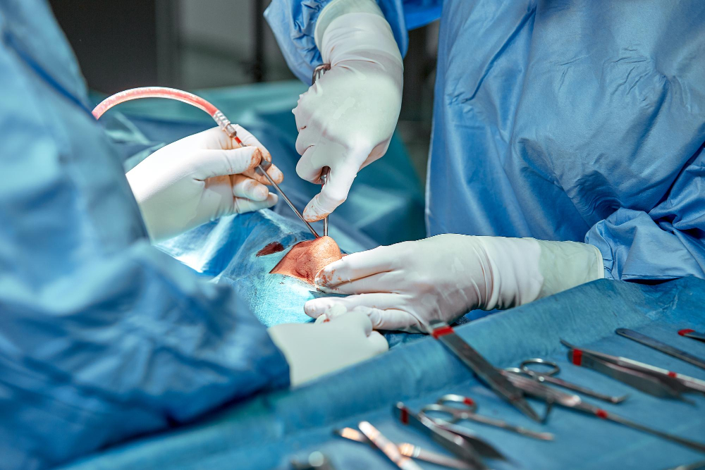 Surgical Extractions2