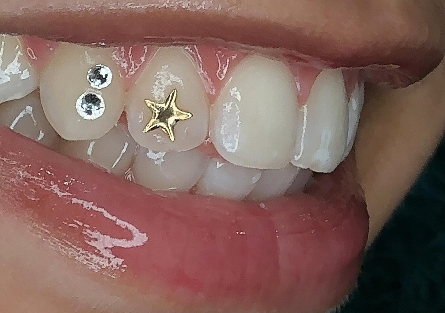 Teeth Jewellery1