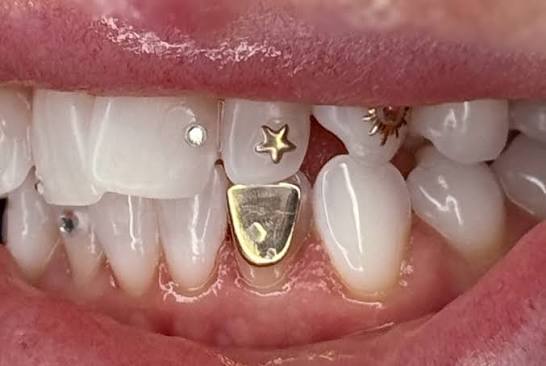 Teeth Jewellery2