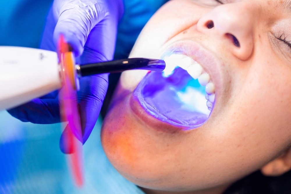 Tooth-Coloured Restorations1-100kb