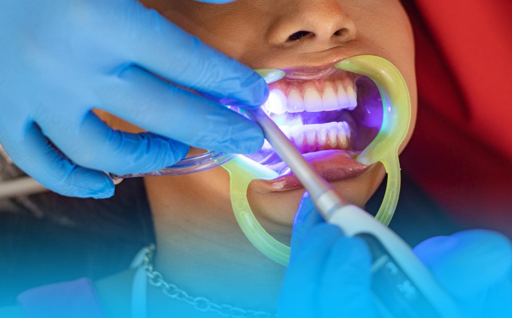 Tooth-Coloured Restorations3-100kb