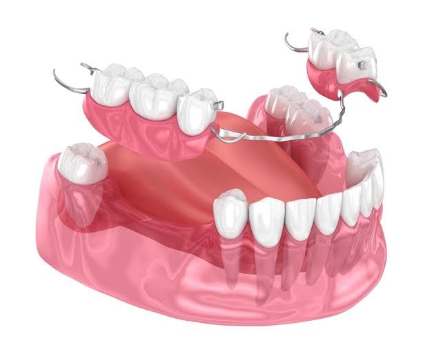 partial-dentures-2-100kb